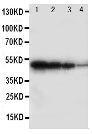 Anti-BMPR1B Antibody Picoband® Boster Bio