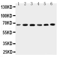 Anti-CETP Antibody Picoband® Boster Bio