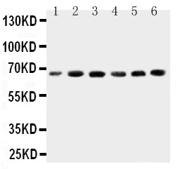 Anti-CETP Antibody Picoband® Boster Bio
