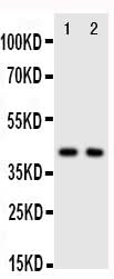 Anti-CXCR5 Antibody Picoband® Boster Bio