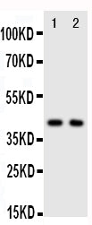 Anti-CXCR5 Antibody Picoband® Boster Bio