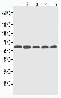 Anti-Cytochrome P450 2U1 CYP2U1 Antibody Picoband® Boster Bio