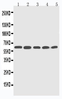 Anti-Cytochrome P450 2U1 CYP2U1 Antibody Picoband® Boster Bio