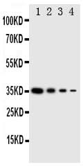 Anti-GCN2/EIF2AK4 Antibody Picoband® Boster Bio