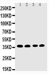 Anti-EIF2S1 Antibody Picoband® Boster Bio