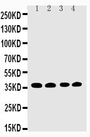 Anti-EIF2S1 Antibody Picoband® Boster Bio