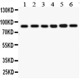 Anti-IKK beta/IKBKB Antibody Picoband® Boster Bio