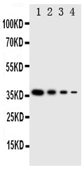 Anti-NTAL/LAT2 Antibody Picoband® Boster Bio
