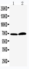 Anti-PADI4/PAD4 Antibody Picoband® Boster Bio