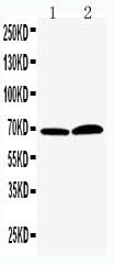 Anti-PADI4/PAD4 Antibody Picoband® Boster Bio