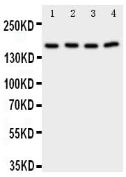 Anti-Phospholipase A2/PLA2G4A Antibody Picoband® Boster Bio
