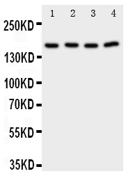 Anti-Phospholipase A2/PLA2G4A Antibody Picoband® Boster Bio