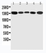 Anti-RGS3 Antibody Picoband® Boster Bio