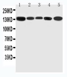 Anti-RGS3 Antibody Picoband® Boster Bio