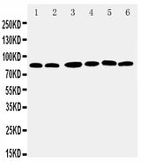 Anti-RSK1 p90/RPS6KA1 Antibody Picoband® Boster Bio