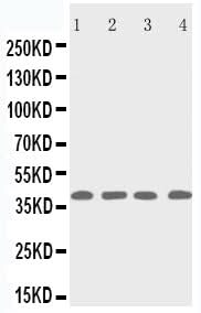 Anti-p53R2/RRM2B Antibody Picoband® Boster Bio