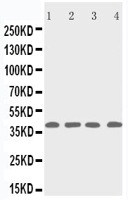 Anti-p53R2/RRM2B Antibody Picoband® Boster Bio