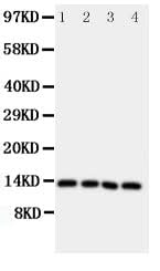 Anti-Somatostatin/SST Antibody Picoband® Boster Bio