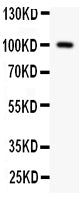 Anti-Prothrombin/F2 Antibody Picoband® Boster Bio