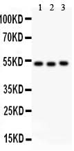 Anti-Factor VII/F7 Antibody Picoband® Boster Bio