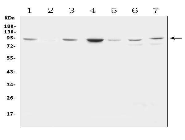 Anti-Factor VIII/F8 Antibody Picoband® Boster Bio