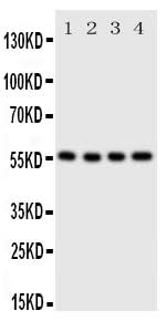 Anti-Glucose Transporter 5 GLUT5/SLC2A5 Antibody Picoband® Boster Bio