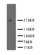 Anti-ABCA4 Antibody Picoband® Boster Bio