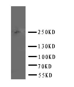 Anti-ABCA4 Antibody Picoband® Boster Bio