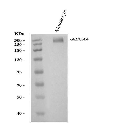 Anti-ABCA4 Antibody Picoband® Boster Bio