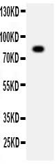 Anti-ADAM2 Antibody Picoband® Boster Bio