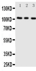 Anti-ADAMTS1 Antibody Picoband® Boster Bio