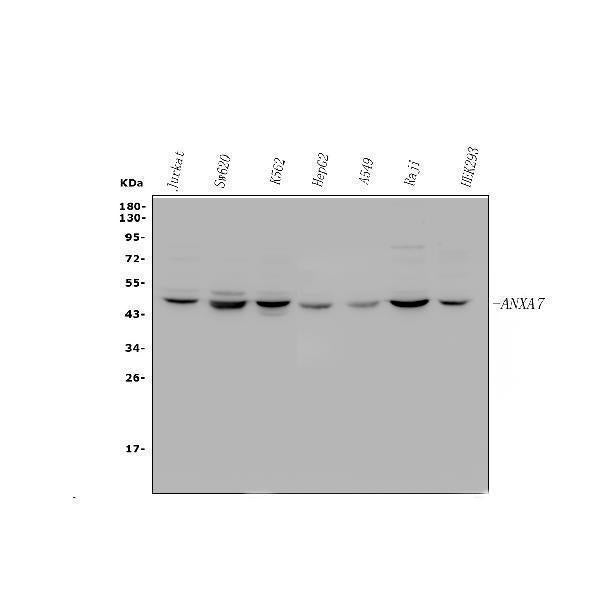 Anti-Annexin VII/ANXA7 Antibody Picoband® Boster Bio