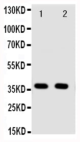 Anti-Annexin A10/ANXA10 Antibody Picoband® Boster Bio