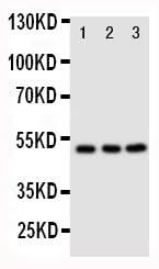 Anti-CXCR4 Antibody Picoband® Boster Bio