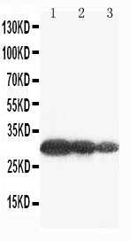 Anti-Aquaporin 6/AQP6 Antibody Picoband® Boster Bio