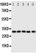Anti-Aquaporin 9/AQP9 Antibody Picoband® Boster Bio