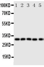 Anti-Aquaporin 9/AQP9 Antibody Picoband® Boster Bio