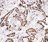 Anti-Amyloid-like protein 1 APLP1 Antibody Picoband® Boster Bio