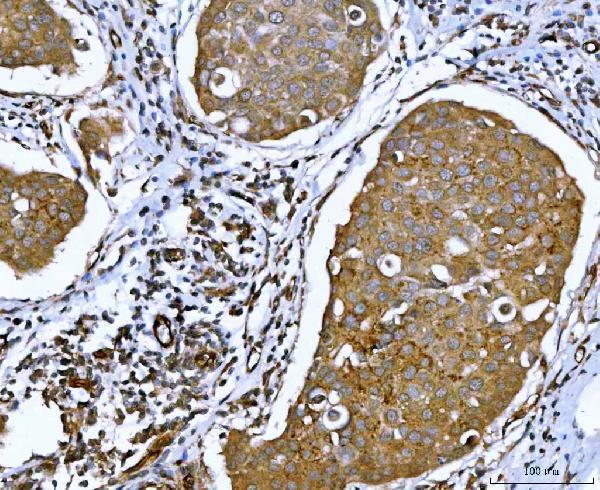 Anti-ATX2/ATXN2 Antibody Picoband® Boster Bio