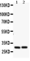Anti-Bcl-2-related protein A1 Bcl2A1 Antibody Picoband® Boster Bio