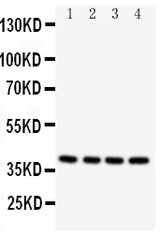 Anti-Caspase-12/CASP12 Antibody Picoband® Boster Bio
