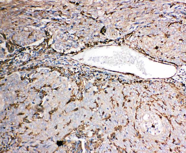 Anti-Gelsolin/GSN Antibody Picoband® Boster Bio