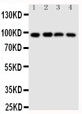 Anti-SIDT1 Antibody Picoband® Boster Bio