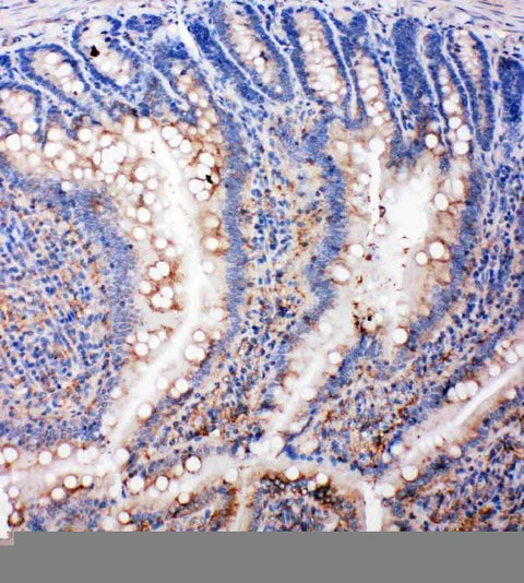 Anti-SMAD5 Antibody Picoband® Boster Bio