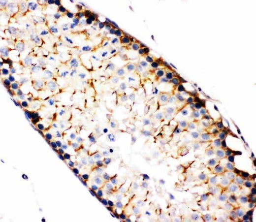 Anti-NAK/TBK1 Antibody Picoband® Boster Bio