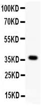 Anti-Protein Wnt-4 Wnt4 Antibody Picoband® Boster Bio