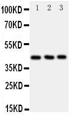 Anti-C-C chemokine receptor type 9 CCR9 Antibody Picoband® Boster Bio