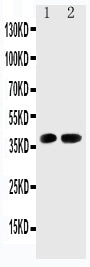 Anti-Cyclin-dependent kinase 6 Cdk6 Antibody Picoband® Boster Bio