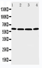 Anti-P2X6/P2RX6 Antibody Picoband® Boster Bio