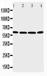Anti-P2X6/P2RX6 Antibody Picoband® Boster Bio